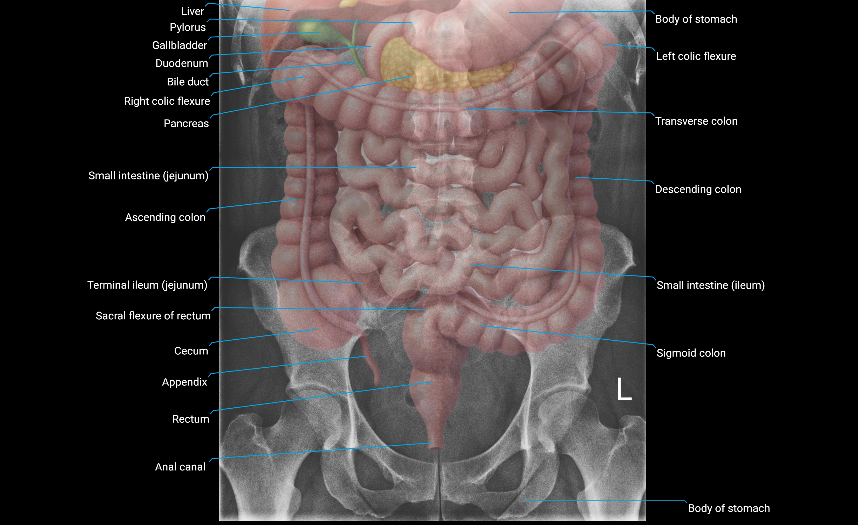 X Ray Digestive system  anatomy labeled.webp